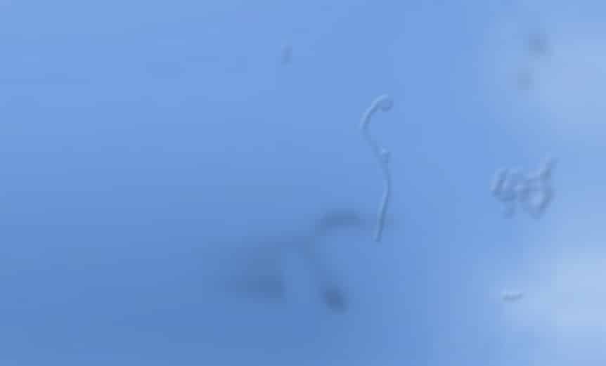 Prompt care of reported 'floaters' saved man's sight Spectrum